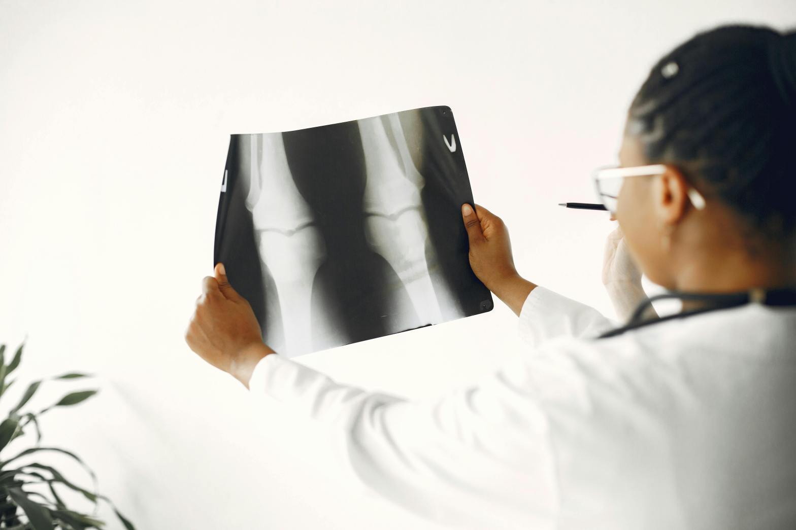 Orthopedist reviews x-ray image of two joints, one with an injury